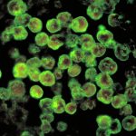 Naegleria Fowleri: Fatal Brain-Eating Amoeba Infection in Georgia Freshwater Lakes